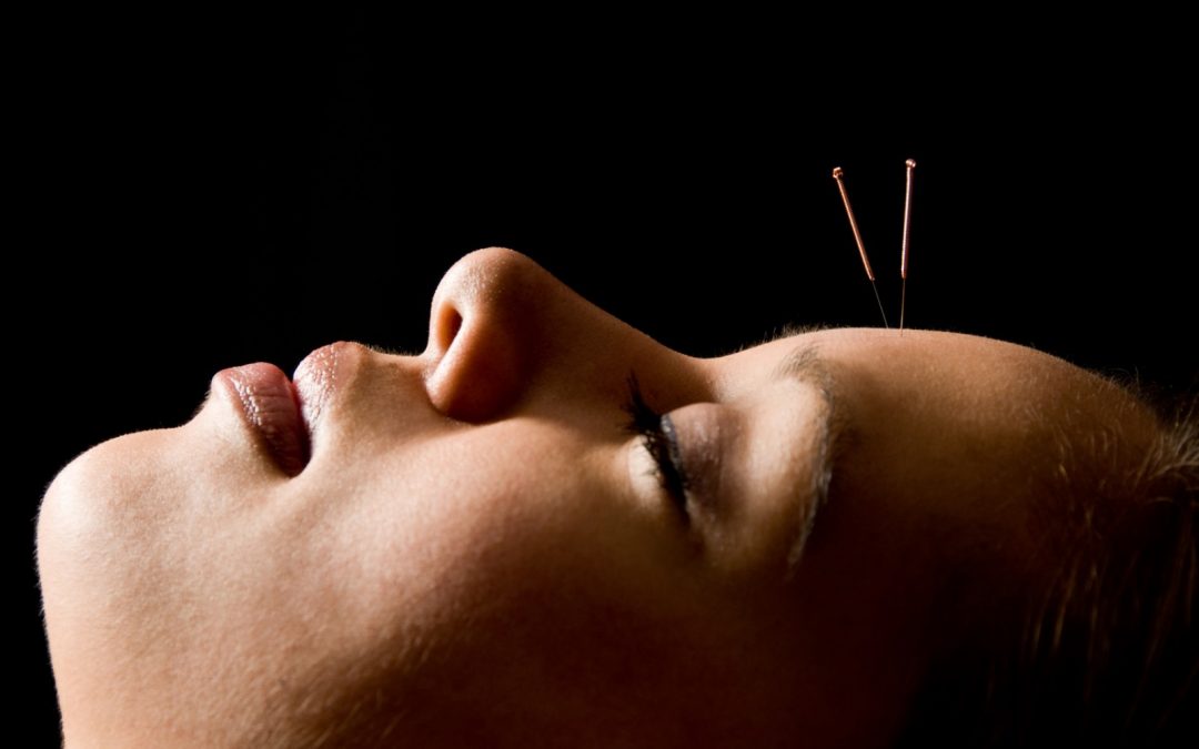 Qué sabes sobre la acupuntura y sus tratamientos para las enfermedades oculares